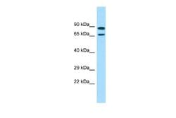 POF1B Rabbit anti-Human, Polyclonal, Novus Biologicals 0.1ml; Unconjugated:Antibodies,